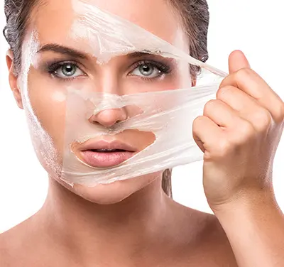 Chemical Peel for Pigmentation