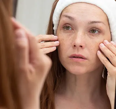 Pigmentation Treatment