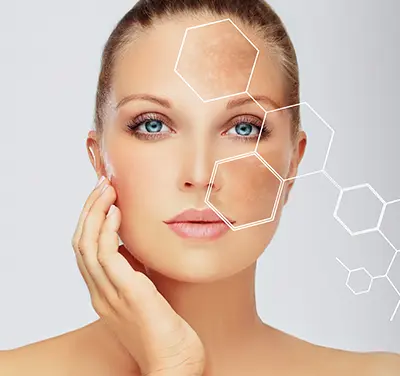 Skin Pigmentation Treatment